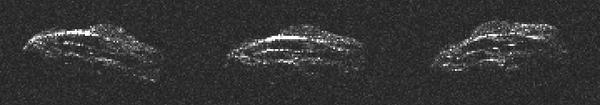 Diese drei Arecibo-Bilder des an Platin reichem Asteroiden 2011 UW158 zeigen vier Minuten von der 37-minütigen Rotationsperiode. Jedes Pixel entspricht 7,5 m. Die Oberfläche sieht aus wie eine Walnuß mit parallelen Furchen entlang der Länge des Objekts.
